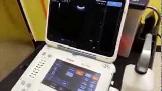 Dr. Marty Henderson of SonoVet walks you through the video clip save functions on his MyLabAlpha.
