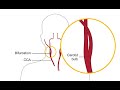 The anatomy of the extracranial arteries   a review