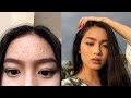 HOW TO CLEAR SKIN FAST + MY SKINCARE ROUTINE | Jessica Vu