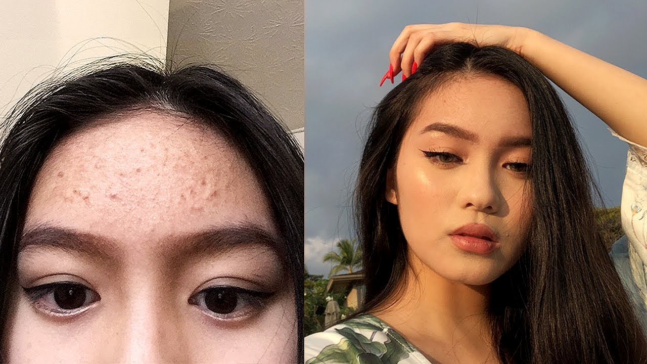 HOW TO CLEAR SKIN FAST + MY SKINCARE ROUTINE | Jessica Vu
