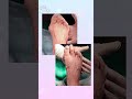 На операционном столе действительно творятся чудеса