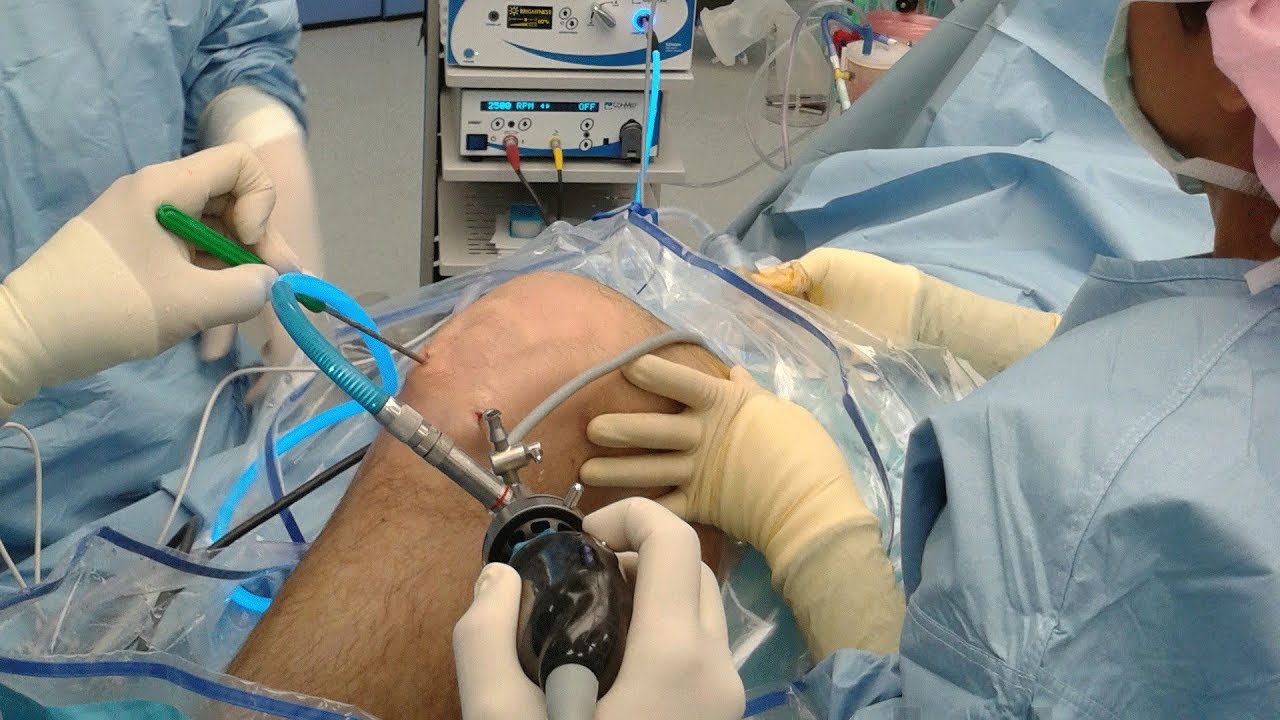 What is Guided Personalised Surgery? - Dr. Lokesh A Veerappa