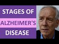 Alzheimers stages what are the stages of alzheimers disease nursing nclex