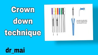 افضل شرح لل  Cleaning and shaping technique(Crown down manual instrumentation technique)