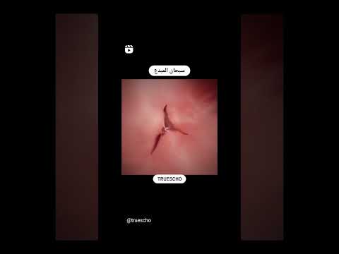 رحلة داخل القلب
