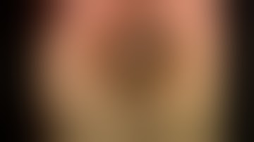 DMEK graft preparation using modified "liquid bubble" thechnique