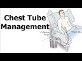 Chest tube management