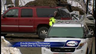 Man injured in Chichester fire