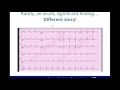 Preoperative Evaluation - Cardiovascular Outcomes