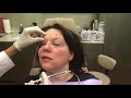 Bells Palsy Patient in New Jersey Shares Her Testimonial