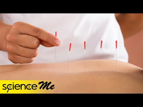 فيديو: كيفية استخدام نقاط العلاج بالابر لألم القدم: 10 خطوات
