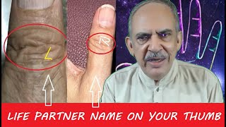 आपके अंगूठे पर किसका नाम लिखा है? Life partner name on thumb@adbistan