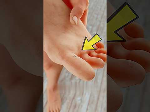 اگه یه تیکه چوب تیز رفت تو پات اینجوری بدون درد درارش سرگرمی دانستنی فان فکتنامه