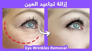 How to naturally get rid of eye wrinkles