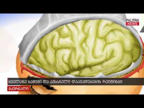 ყველაზე საშიში და აუხსნელი დაავადებების რეიტინგი