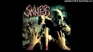 Watch Skinless Spoils Of The Sycophant video
