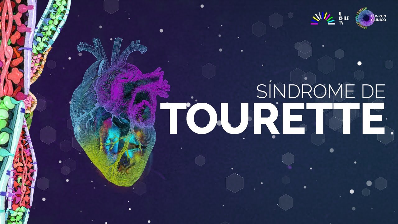 Con Ojo Clínico: Síndrome de Tourette