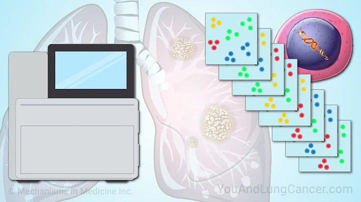 Understanding Next-Generation Sequencing and Comprehensive Genomic Profiling for Lung Cancer