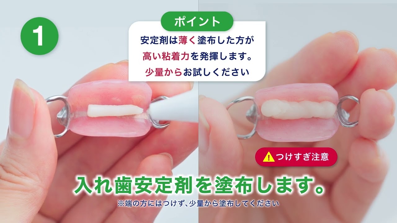 入れ歯 接着 剤