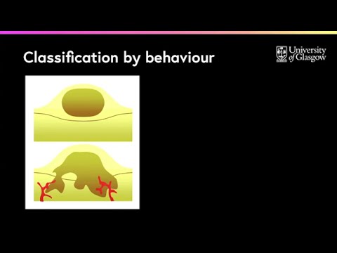 Video: Is neoplasie benigne of kwaadaardig?