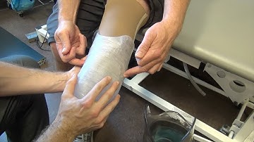 Using 3D printers to help build prosthetic sockets