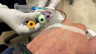 30 Second Multiple Myeloma Treatment Experience At Dfci