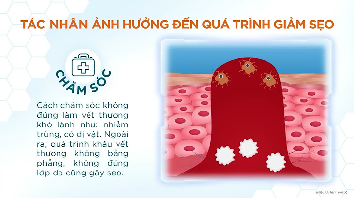 Hướng dẫn sử dụng scarz