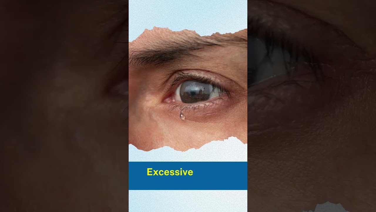 Dry Eyes? Signs, Symptoms & When to See a Doctor!