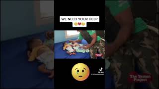 The Yemen Project Children Starving To Death