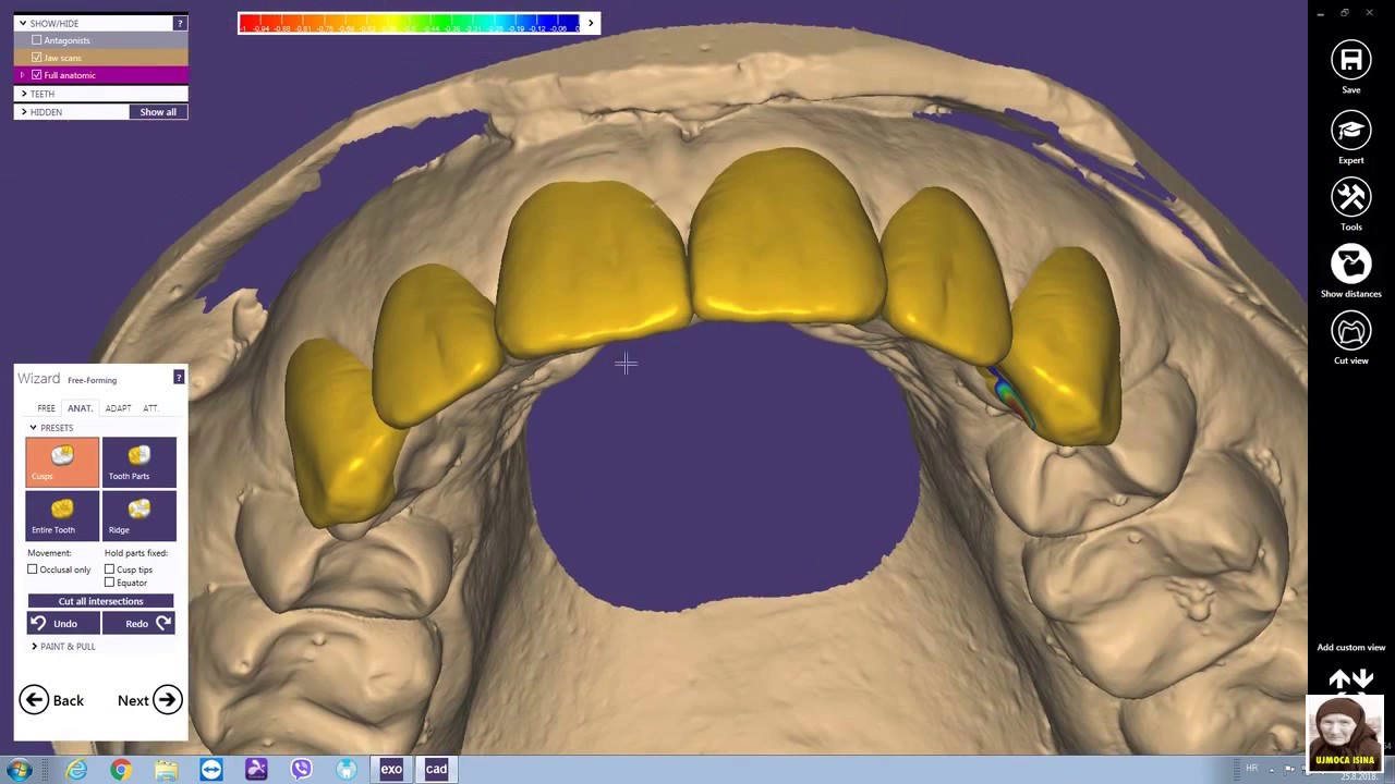 exocad digital mockup