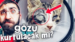 Efes'in Gözüne NE OLDU? 