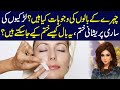 What are the causes of facial hair how will it end  dr sahar chawla