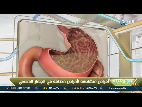 يوم جديد| تعرف على الأمراض الأكثر شيوعا في الجهاز الهضمي