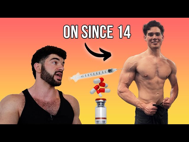 l carnitine looksmax LooksMaxxers Are BLASTING Gear ... For NOOB Gains (Cycles Revealed)