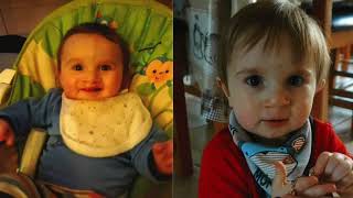 Harrys Journey Through The Ni Cleft Lip And Palate Service