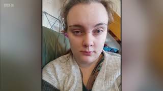 BBC South |  Disability benefit cuts