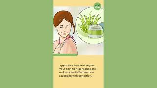 How to Get Rid of Sunburn Fast How To Get Rid Of Sunburn Redness Fast 4943286
