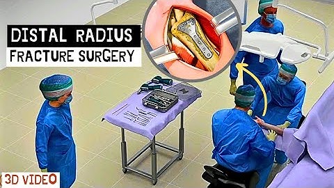 Surgery for distal radius fracture surgery | Osteotomy | #3d #surgery