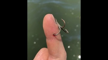 How to remove a treble hook from your finger with no pain