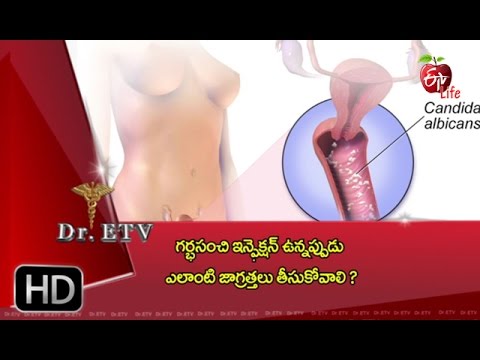Download Dr. ETV | Vaginal infection | 7th March 2017 | డాక్టర్ ఈటివీ