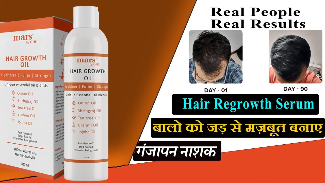 Buy mars by GHC Hair Growth Combo  Hair Growth Oil 200ml  Anti Hair Fall  DHT Blocker Shampoo 200ml  For Hair Growth and Nourishment Controls Hair  Fall For Men and