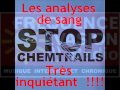 CHEMTRAILS  le poison du ciel -témoignage sur Fréquence Evasion