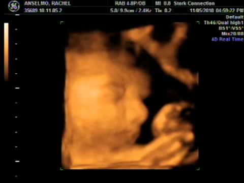 Baby Sophia Anselmo 3D Ultrasound 11-5-2010 (Part 1)