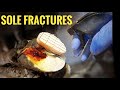 WHAT ON EARTH IS A SOLE FRACTURE!? | The Hoof GP