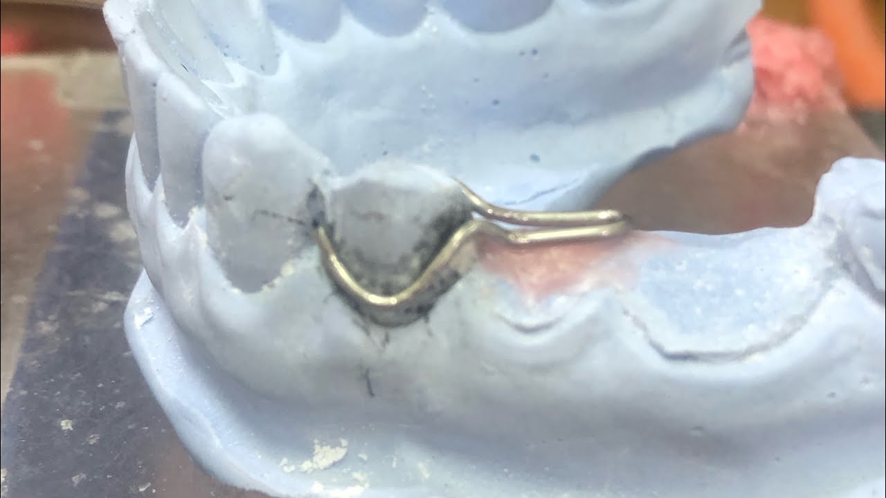 🔰学生向け　ワイヤー曲げ4番   徹底解説②