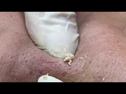 Video Mặt Sơn 2002 Q3(spa Hải Âu sg 491/72 Nguyễn đình chiểu... - youtube