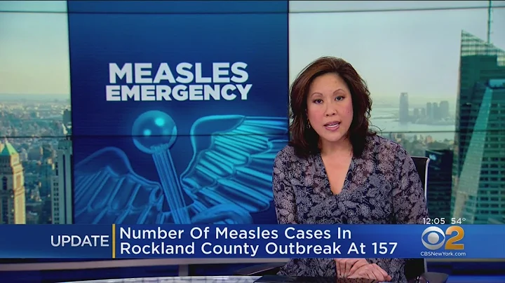 Rockland County Measles Outbreak Up To 157 Cases