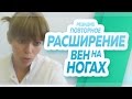 Рецидив варикозной болезни, повторное расширение вен на ногах. Флебологический центр "Антирефлюкс"