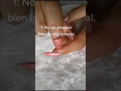 Video: ¿Están bien las uñas acrílicas para la cirugía?