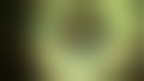 Phacoemulsification Multifocal IOl Dr Ahmed Elmassry